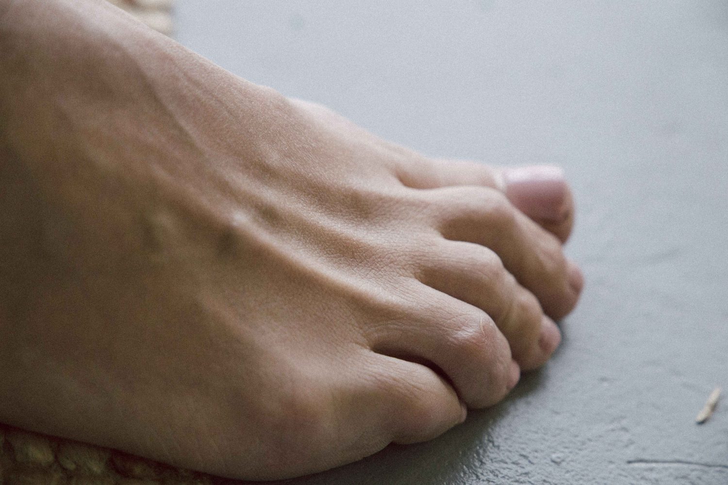 Close-up of diabetic foot on floor showing skin texture and toe alignment, highlighting early signs of foot pain