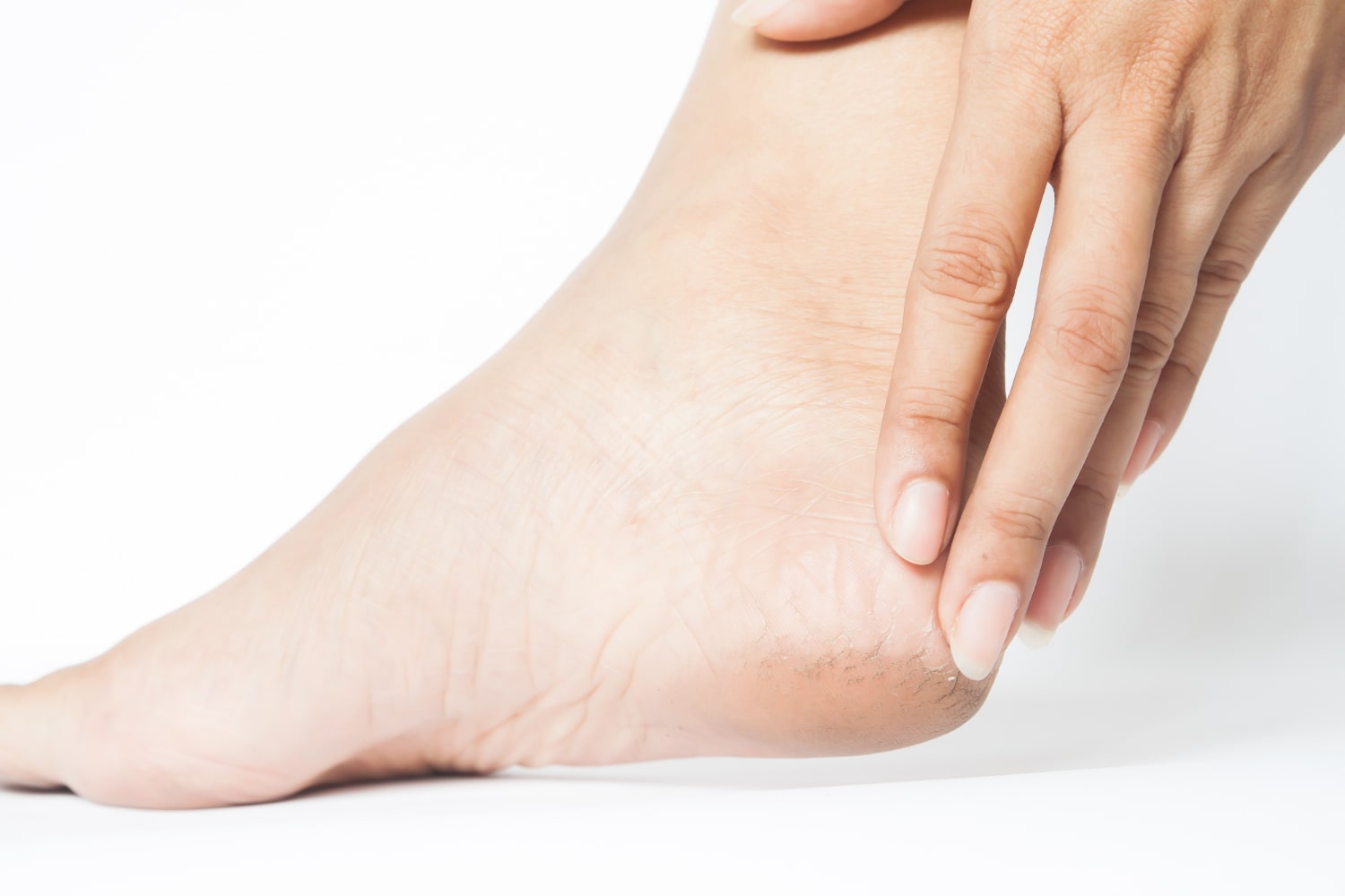 Dry Skin on Diabetic Feet: Know the Risks